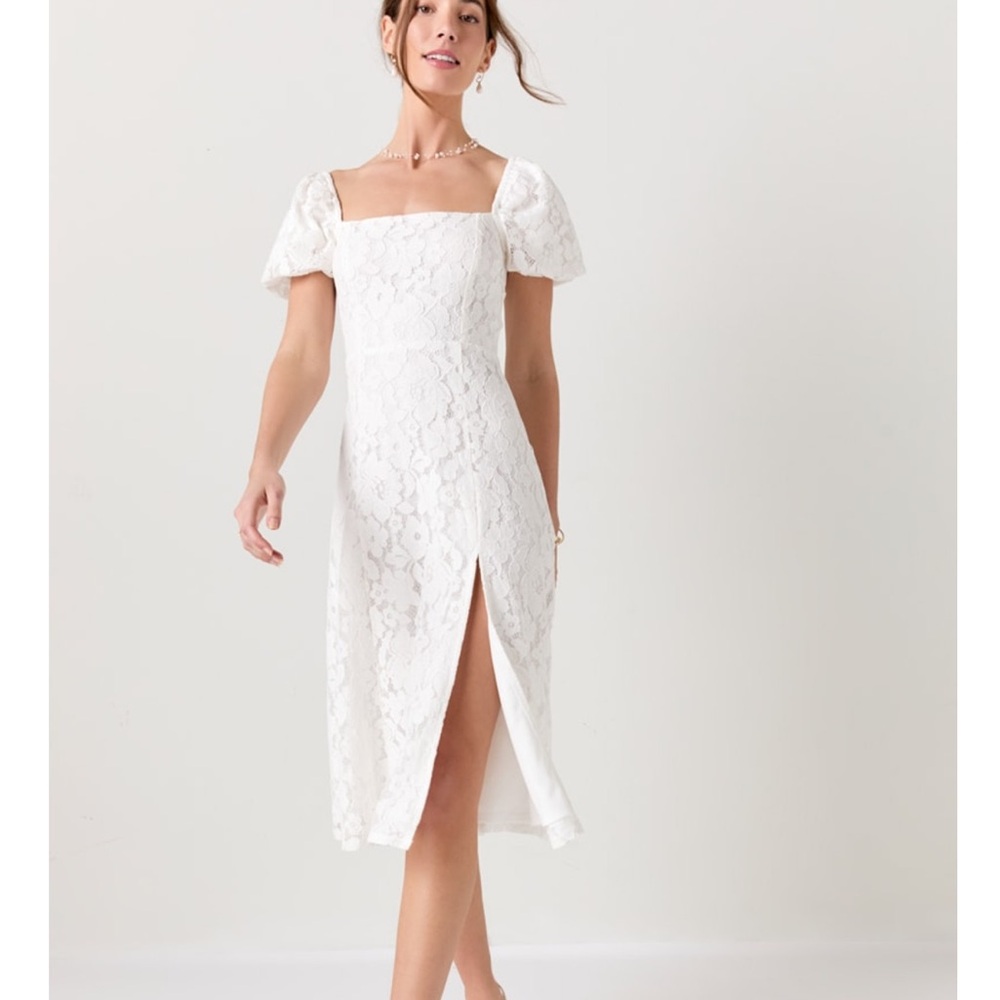 Francesca’s lace dress